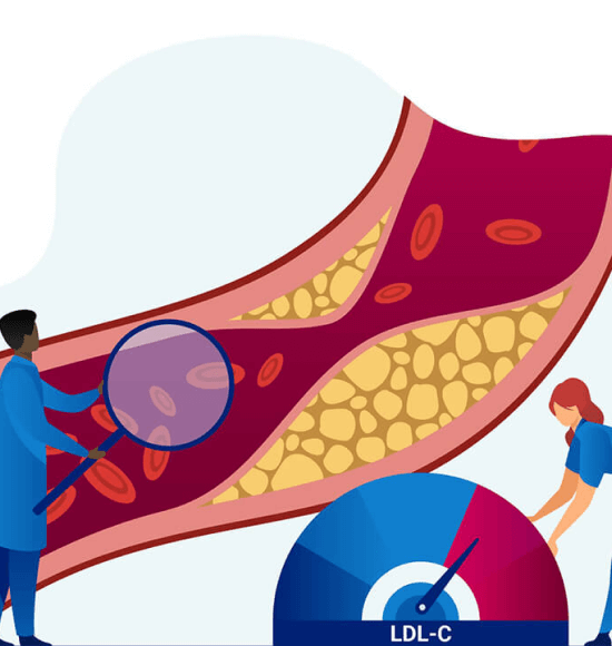 A graphic showing the impact of high LDL-C levels in the wall of a blood vessel.